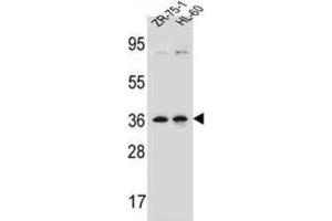 Western Blotting (WB) image for anti-Leucine Zipper Protein 2 (LUZP2) antibody (ABIN2997192) (LUZP2 抗体)