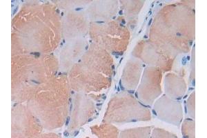 Detection of MYLK2 in Mouse Skeletal muscle Tissue using Polyclonal Antibody to Myosin Light Chain Kinase 2 (MYLK2) (MYLK2 抗体  (AA 330-548))