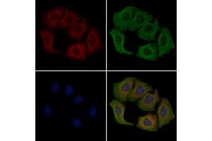 ABIN6260771 and ABIN6279279 staining Hela cells by IF/ICC. (CEP72 抗体)