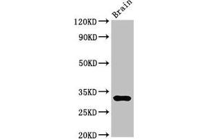 Western Blot Positive WB detected in: Mouse brain tissue All lanes: DNASE1 antibody at 3 μg/mL Secondary Goat polyclonal to rabbit IgG at 1/50000 dilution Predicted band size: 32, 20 kDa Observed band size: 32 kDa (DNASE1 抗体  (AA 78-231))
