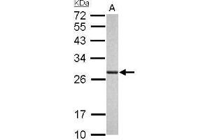 Western Blotting (WB) image for anti-Proteasome Subunit alpha 6 (PSMA6) (Center) antibody (ABIN2856913)