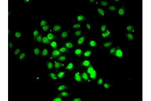 Immunofluorescence analysis of U2OS cells using RFX5 antibody (ABIN5974192). (RFX5 抗体)