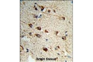 Formalin-fixed and paraffin-embedded human brain tissue reacted with FMOD Antibody (C-term), which was peroxidase-conjugated to the secondary antibody, followed by DAB staining. (Fibromodulin 抗体  (C-Term))