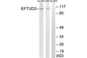 Western blot analysis of extracts from 293/HuvEc cells, using EFTUD2 Antibody. (EFTUD2 抗体  (AA 321-370))