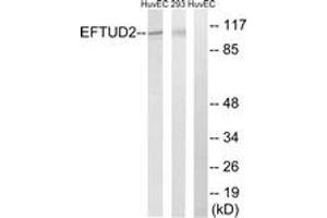 Western Blotting (WB) image for anti-Elongation Factor Tu GTP Binding Domain Containing 2 (EFTUD2) (AA 321-370) antibody (ABIN1534496)