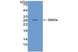 Western blot analysis of recombinant Human aZGP1. (AZGP1 抗体)