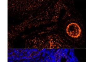 Immunofluorescence analysis of Mouse oophoroma cells using ZP2 Polyclonal Antibody at dilution of 1:100. (ZP2 抗体)