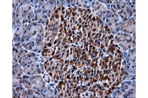 Immunohistochemical staining of paraffin-embedded colon tissue using anti-MCL1 mouse monoclonal antibody. (MCL-1 抗体)