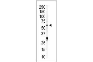 Western Blotting (WB) image for anti-Phosphatidylinositol-4-Phosphate 5-Kinase, Type I, alpha (PIP5K1A) (AA 19-50), (N-Term) antibody (ABIN392593)