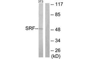 Western blot analysis of extracts from NIH-3T3 cells, treated with PMA 125ng/ml 30', using SRF (Ab-99) Antibody. (SRF 抗体  (AA 71-120))