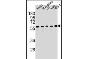 X1 Antibody (C-term) (ABIN654415 and ABIN2844152) western blot analysis in HepG2,MDA-M,293,K562,MCF-7 cell line lysates (35 μg/lane). (PAX1 抗体  (C-Term))