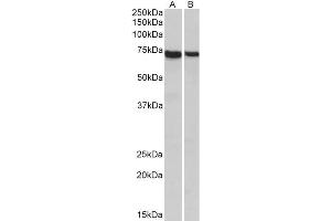 ABIN2613455 (1µg/ml) staining of Mouse (A) and Rat (B) Spleen lysates (35µg protein in RIPA buffer). (STXBP3 抗体  (Internal Region))