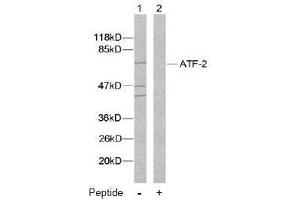 Image no. 2 for anti-Activating Transcription Factor 2 (ATF2) (Ser112), (Ser94) antibody (ABIN197152) (ATF2 抗体  (Ser94, Ser112))