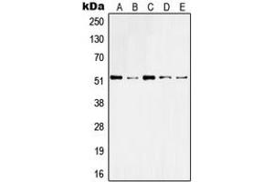 Western blot analysis of Cytokeratin 10 expression in HeLa (A), A431 (B), Raw264. (Keratin 10 抗体  (Center))