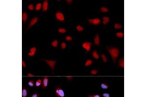 Immunofluorescence analysis of MCF-7 cells using Phospho-ABL1(Y204) Polyclonal Antibody (ABL1 抗体  (pTyr204))