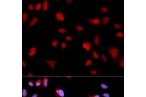 Immunofluorescence analysis of MCF-7 cells using Phospho-ABL1(Y204) Polyclonal Antibody