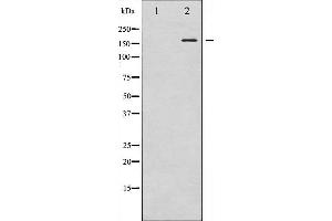 Western blot analysis of VEGFR2 phosphorylation expression in Na3VO4 treated HepG2 whole cell lysates,The lane on the left is treated with the antigen-specific peptide. (VEGFR2/CD309 抗体  (pTyr1059))