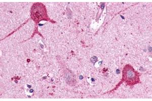 Anti-OPN3 / Encephalopsin antibody  ABIN1049165 IHC staining of human brain, neurons and glia.