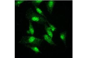 Immunofluorescence (IF) image for anti-K(lysine) Acetyltransferase 2A (KAT2A) (AA 411-837) antibody (ABIN487349) (KAT2A 抗体  (AA 411-837))
