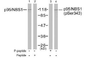 Image no. 2 for anti-Nibrin (NBN) (Ser343) antibody (ABIN197201) (Nibrin 抗体  (Ser343))