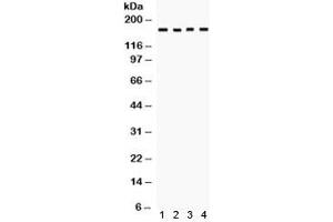 Western blot testing of human 1) 293, 2) SW620, 3) COLO320 and 4) HeLa cell lysate with HKDC1 antibody.