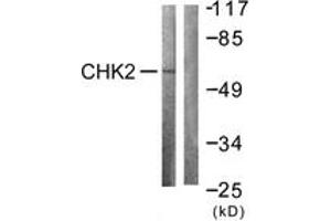 Western blot analysis of extracts from COS7 cells treated with UV 30', using Chk2 (Ab-383) Antibody. (CHEK2 抗体  (AA 356-405))