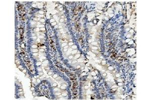 anti-Methylmalonyl Coenzyme A Mutase (MUT) (N-Term) antibody