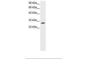 Image no. 3 for anti-Jumonji Domain Containing 8 (JMJD8) (AA 111-160) antibody (ABIN6735793) (JMJD8 抗体  (AA 111-160))