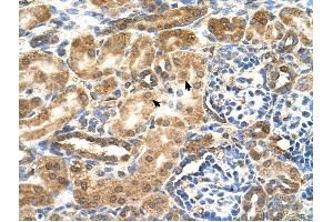 GCNT3 antibody was used for immunohistochemistry at a concentration of 4-8 ug/ml to stain EpitheliaI cells of renal tubule (arrows) in Human Kidney. (GCNT3 抗体)