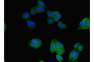 Immunofluorescent analysis of HepG2 cells using ABIN7170364 at dilution of 1:100 and Alexa Fluor 488-congugated AffiniPure Goat Anti-Rabbit IgG(H+L) (SNX17 抗体  (AA 280-457))