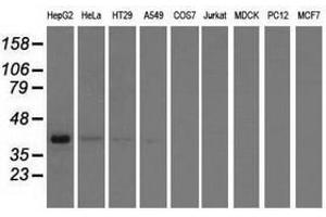 Image no. 3 for anti-3-hydroxyisobutyryl-CoA Hydrolase (HIBCH) antibody (ABIN1498655) (HIBCH 抗体)