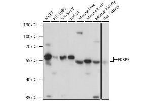 Western blot analysis of extracts of various cell lines, using FKBP5 antibody. (FKBP5 抗体  (AA 308-457))