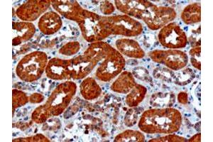 USH1C polyclonal antibody  (10 ug/mL) staining of paraffin embedded human kidney. (USH1C 抗体)