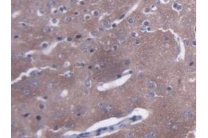 Detection of AMPH in Mouse Cerebrum Tissue using Polyclonal Antibody to Amphiphysin (AMPH) (Amphiphysin 抗体  (AA 24-240))