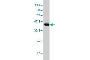 Western Blot detection against Immunogen (36. (PIAS3 抗体  (AA 453-550))