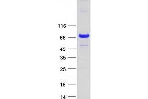 Western Blotting (WB) image for EPS8-Like 1 (EPS8L1) (Transcript Variant 2) protein (Myc-DYKDDDDK Tag) (ABIN2720341)