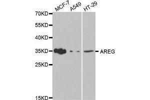 Western blot analysis of extracts of various cell lines, using AREG antibody. (Amphiregulin 抗体  (AA 20-252))