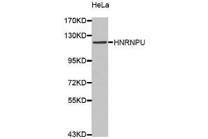 Western Blotting (WB) image for anti-Heterogeneous Nuclear Ribonucleoprotein U (Scaffold Attachment Factor A) (HNRNPU) (AA 608-825) antibody (ABIN6220424) (HNRNPU 抗体  (AA 608-825))