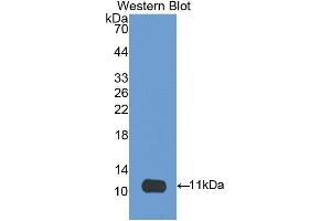 Western Blotting (WB) image for anti-CD3d Molecule, delta (CD3-TCR Complex) (CD3D) (AA 19-99) antibody (ABIN1175139) (CD3D 抗体  (AA 19-99))