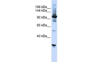 WB Suggested Anti-DIS3 Antibody Titration:  0. (DIS3 抗体  (N-Term))