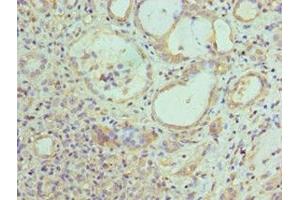 Immunohistochemistry of paraffin-embedded human kidney tissue using ABIN7157845 at dilution of 1:100 (EPM2A 抗体  (AA 244-331))