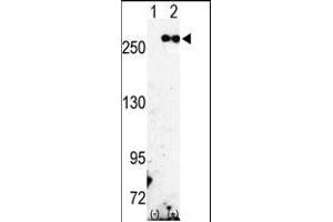 Western blot analysis of FASN (arrow) using rabbit polyclonal FASN Antibody (Center) (ABIN391654 and ABIN2841563). (Fatty Acid Synthase 抗体  (AA 942-973))