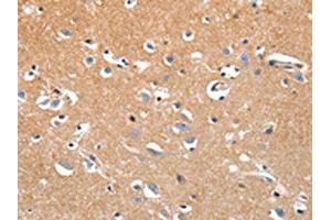 The image on the left is immunohistochemistry of paraffin-embedded Human brain tissue using ABIN7191320(LRP3 Antibody) at dilution 1/80, on the right is treated with synthetic peptide. (LRP3 抗体)