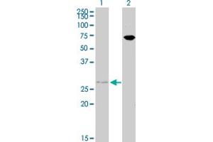 Western Blot analysis of HOXB7 expression in transfected 293T cell line by HOXB7 monoclonal antibody (M02), clone 4A3. (HOXB7 抗体  (AA 55-120))
