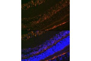 Immunofluorescence analysis of rat eye using CRALBP Rabbit mAb (ABIN7269934) at dilution of 1:100 (40x lens). (RLBP1 抗体)