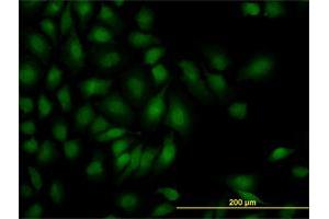 Immunofluorescence (IF) image for anti-SMAD, Mothers Against DPP Homolog 1 (SMAD1) (AA 1-110) antibody (ABIN561713)