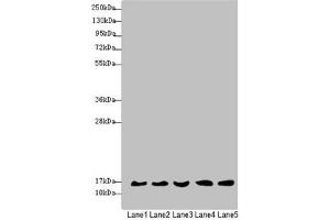 Western blot All lanes: MRPS16 antibody at 1. (MRPS16 抗体  (AA 1-137))