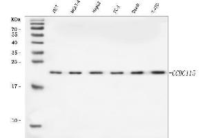 Western blot analysis of CCDC115 using anti-CCDC115 antibody (ABIN7599042).