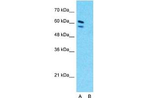 Western Blotting (WB) image for anti-Cystathionine-beta-Synthase (CBS) (N-Term) antibody (ABIN2782348)