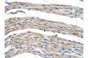SLC17A4 antibody was used for immunohistochemistry at a concentration of 4-8 ug/ml to stain Skeletal muscle cells (arrows) in Human Muscle.